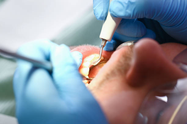Best Same-Day Emergency Dentist in Cloverdale, IN