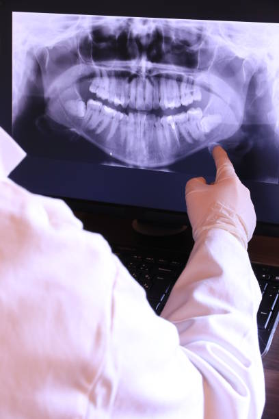 Best After-Hours Emergency Dentist in Cloverdale, IN